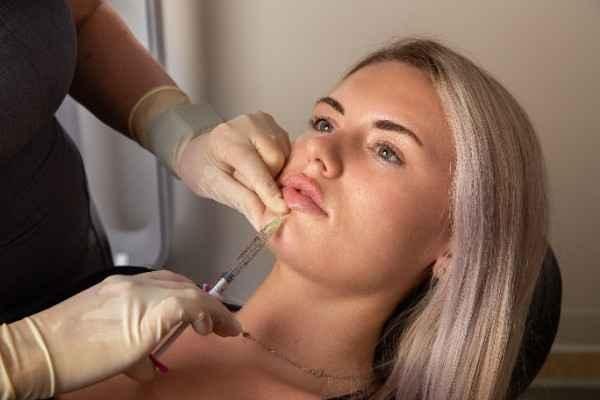 Lip Filler Newcastle