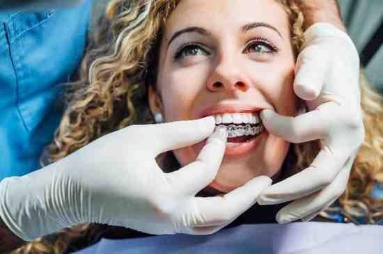 invisalign Eastleigh